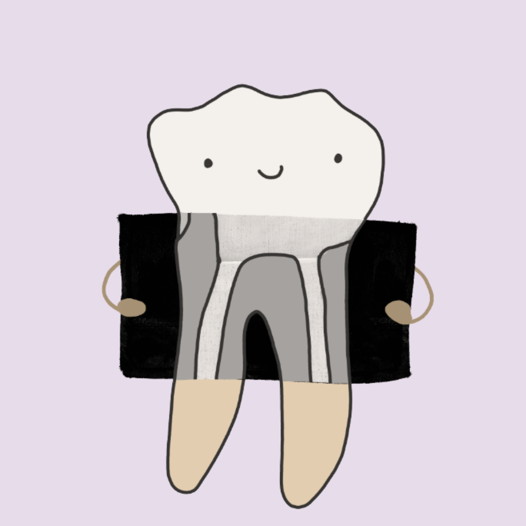Mitos sobre las endodoncias