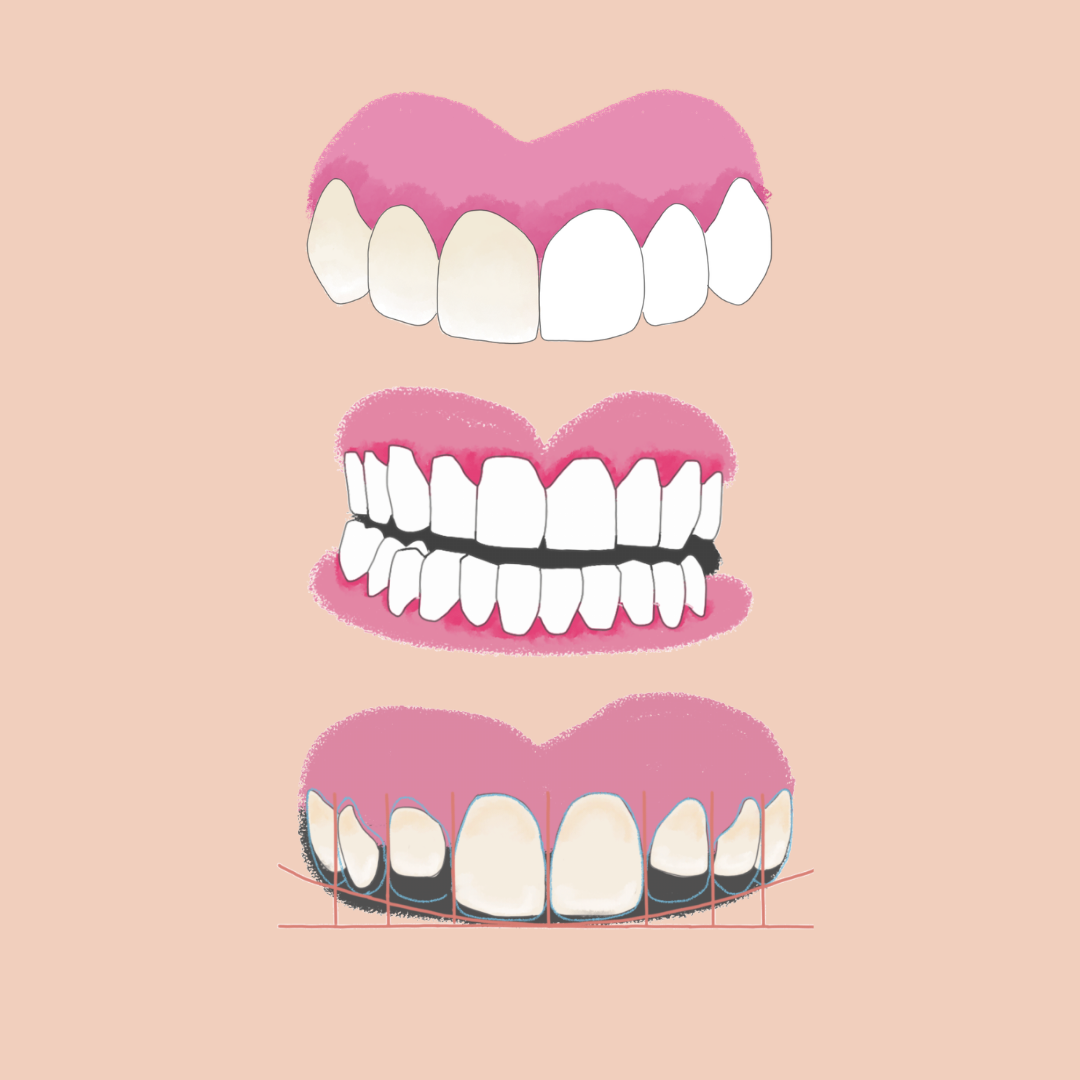 Mitos de la estética dental