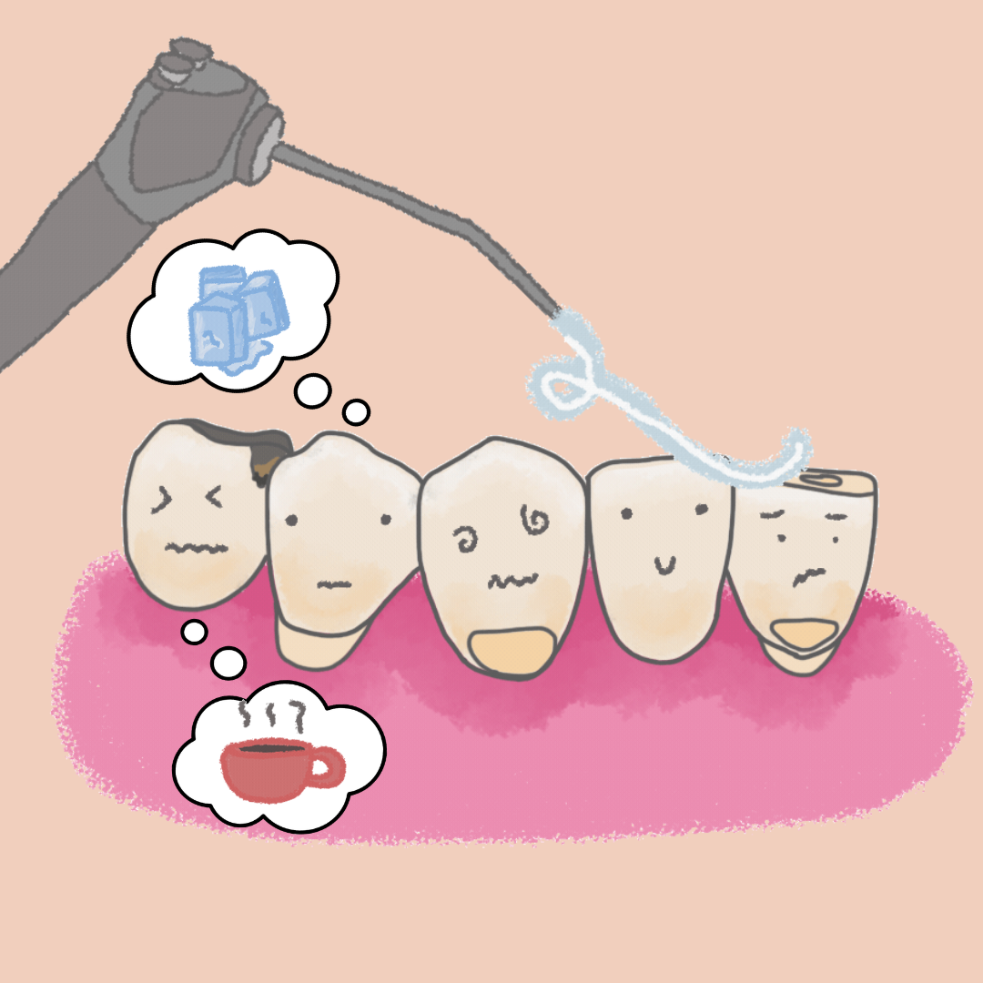 Sensibilidad dental