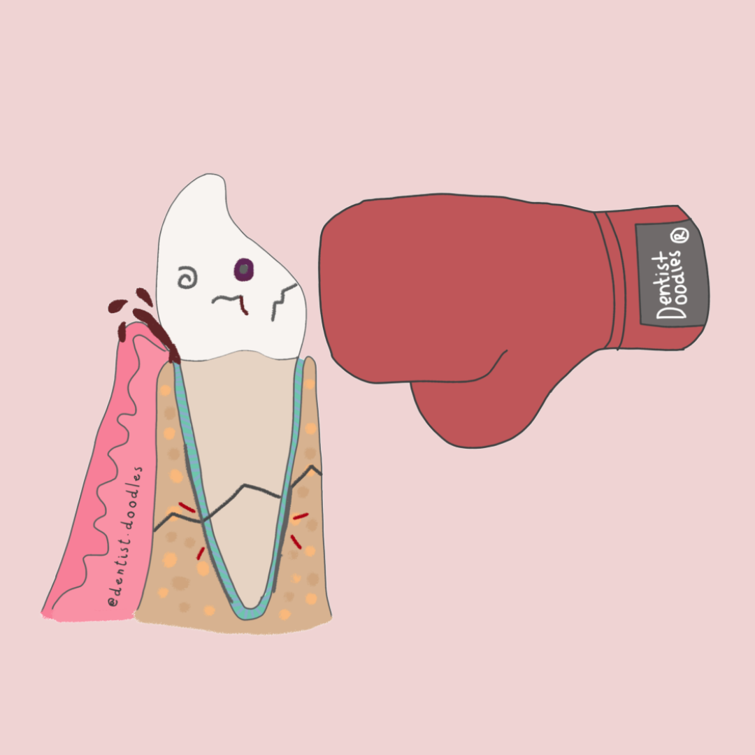 Trauma dental